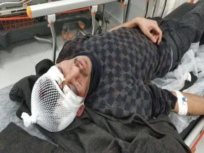 Sopayla 2 kişiyi hastanelik ettiler