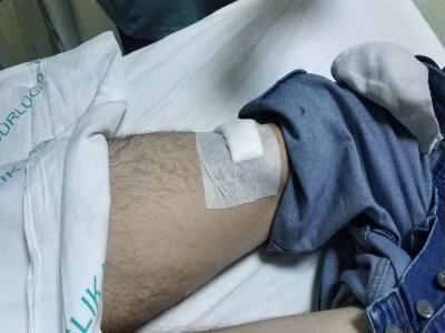 Samsun’da maganda kurşunu evin önünde oturan genci vurdu

