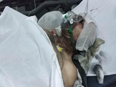 Samsun’da yangın dehşeti: Karı-koca ağır yaralandı
