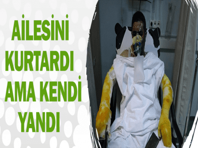 AİLESİNİ KURTARDI AMA KENDİ YANDI