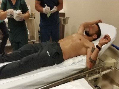 SAMSUN'DA ÇIKAN KAVGADA 2 KİŞİ HASTANELİK